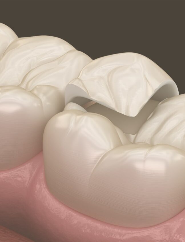 Treatment - Shirland Dental