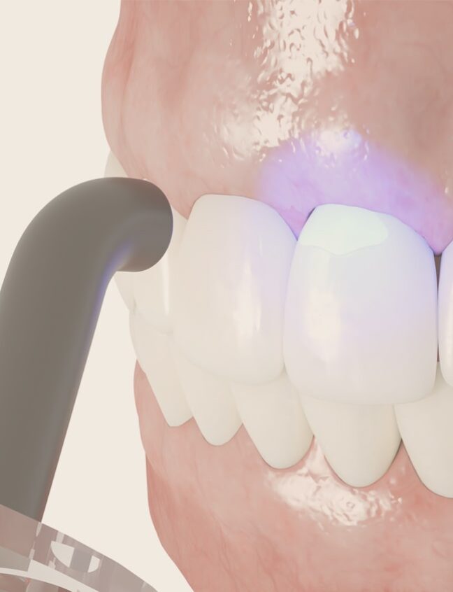 Treatment - Shirland Dental
