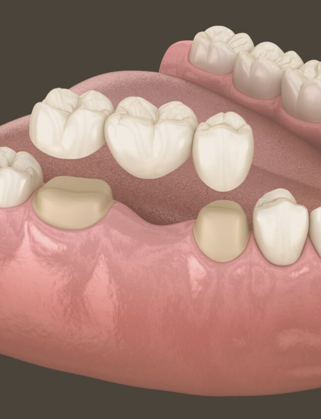 Treatment - Shirland Dental
