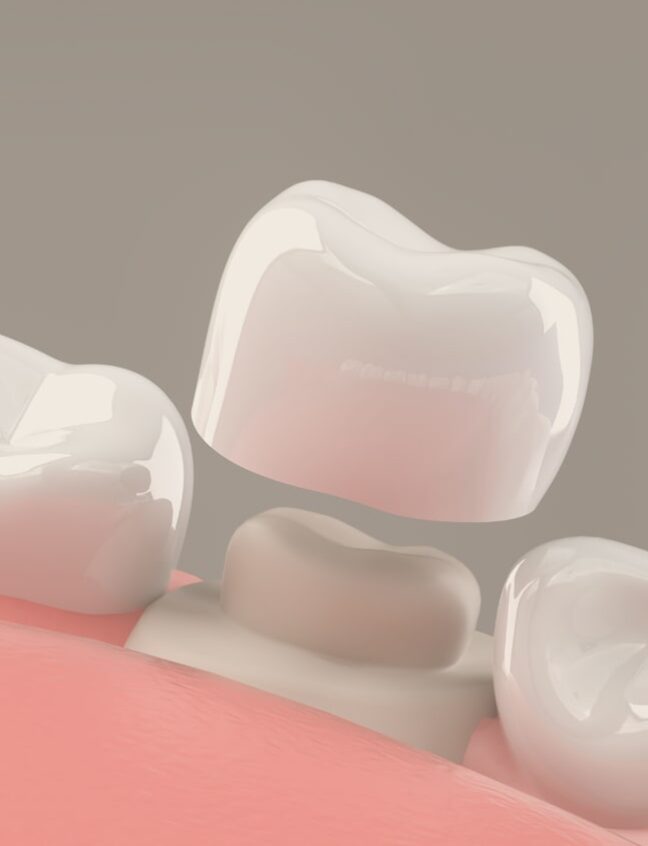 Treatment - Shirland Dental