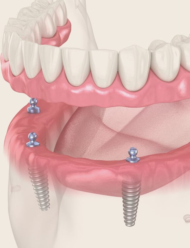 Treatment - Shirland Dental