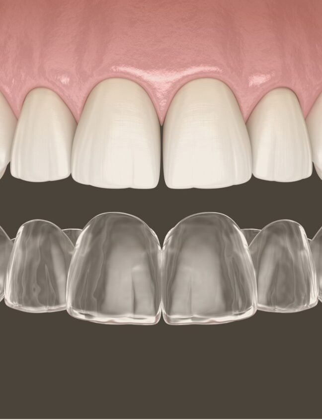 Treatment - Shirland Dental
