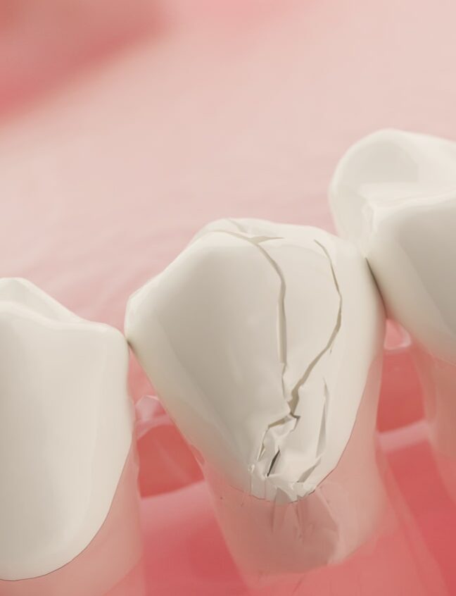 Treatment - Shirland Dental