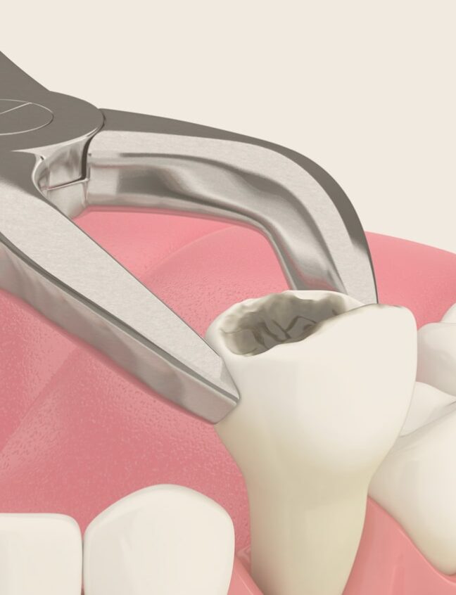 Treatment - Shirland Dental