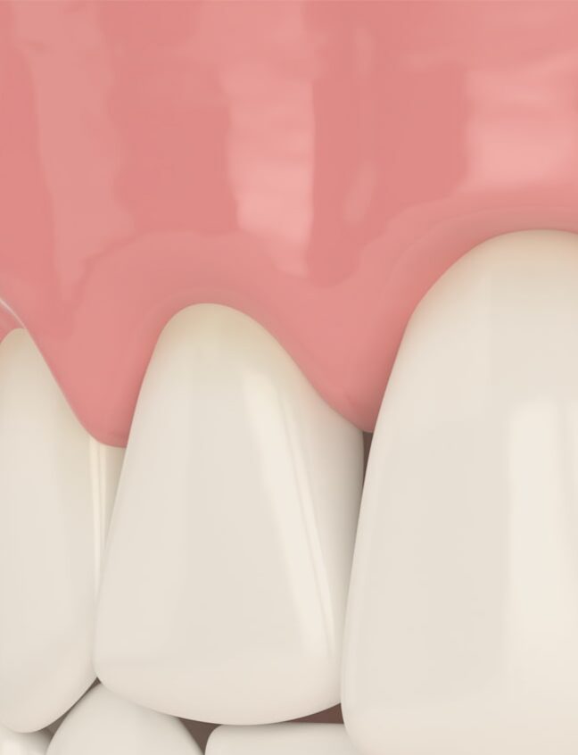 Treatment - Shirland Dental