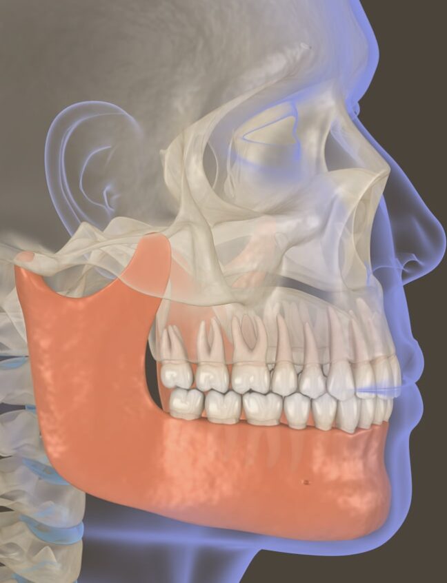 Treatment - Shirland Dental