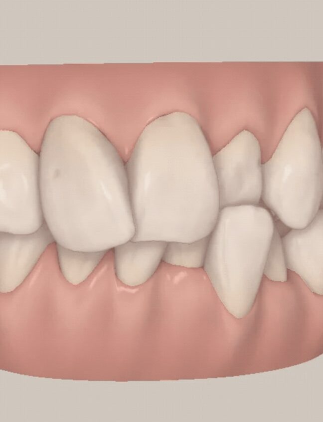 Treatment - Shirland Dental
