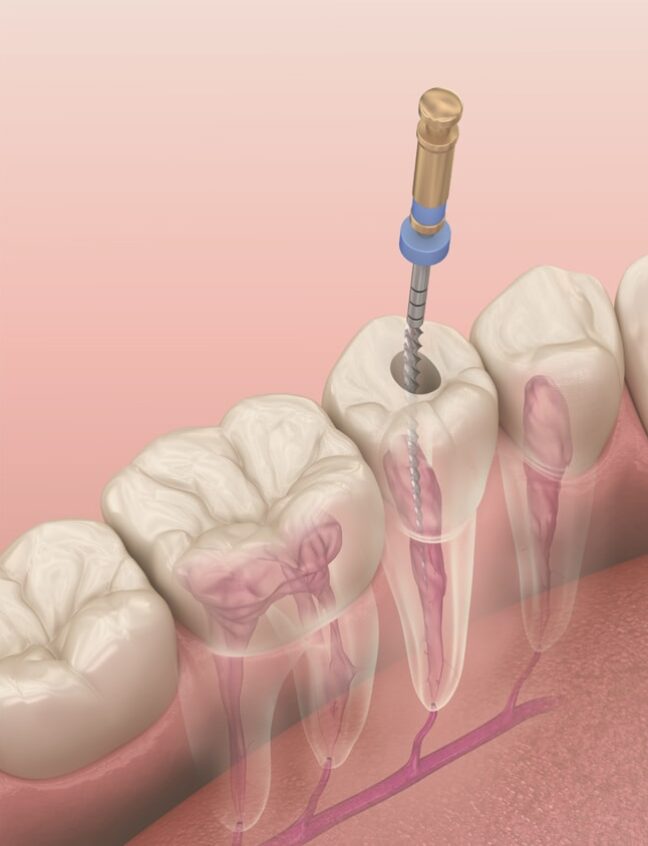 Treatment - Shirland Dental
