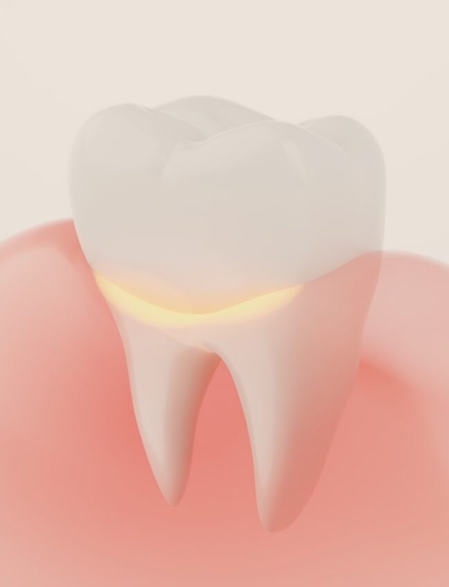 Treatment - Shirland Dental