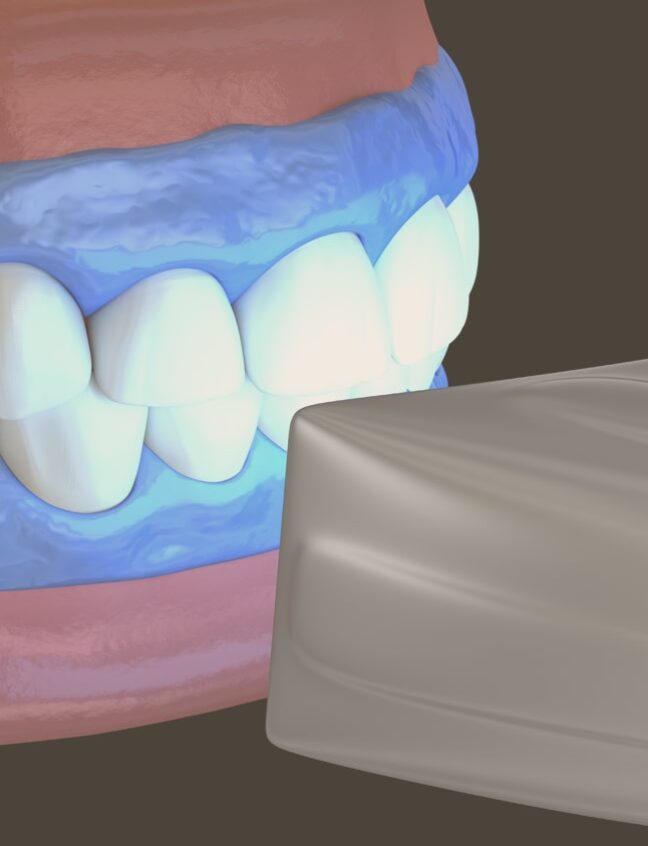 Treatment - Shirland Dental