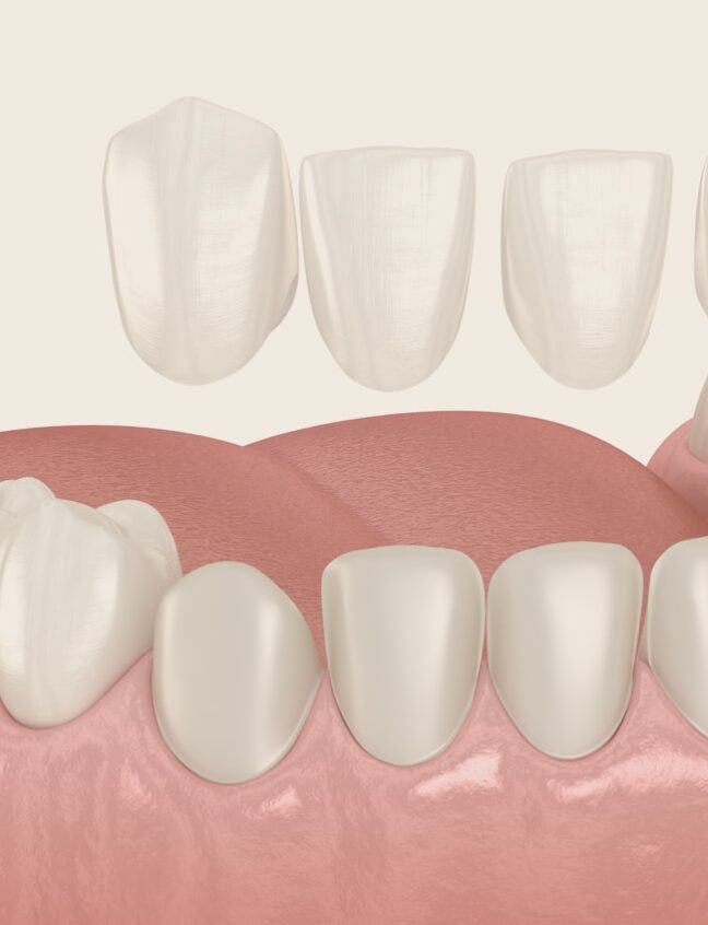 Treatment - Shirland Dental