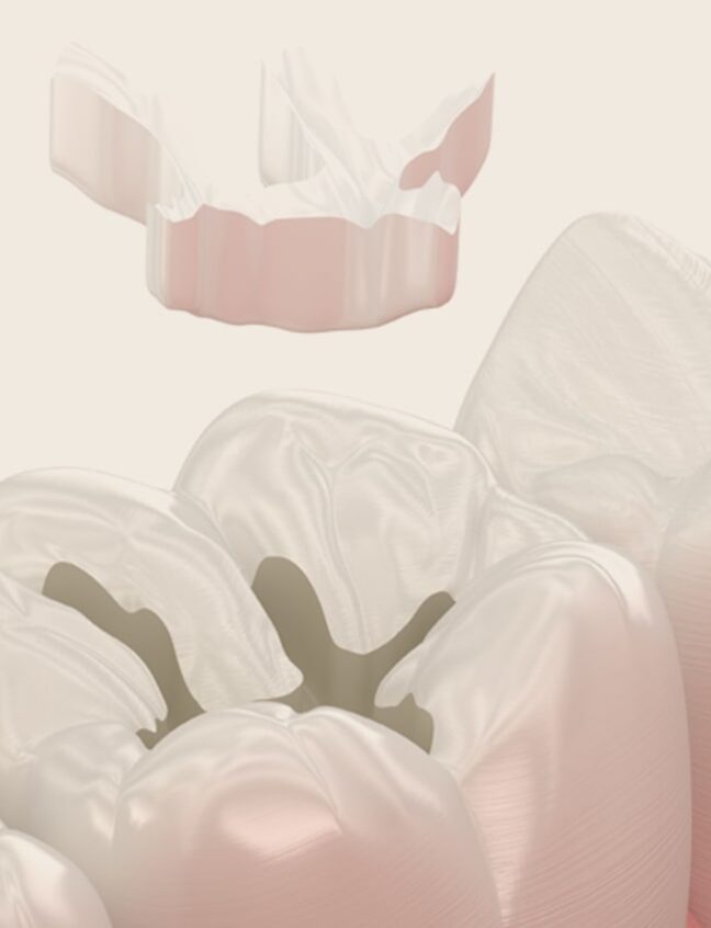 Treatment - Shirland Dental